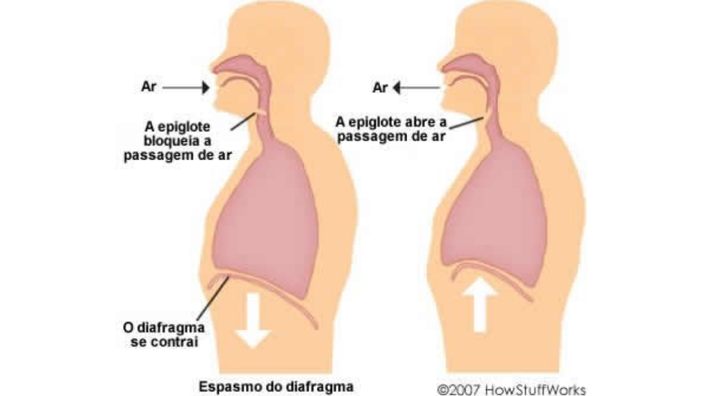 pessoa-com-soluco-2-1-1024x576 Por que temos soluço? Confira 7 curiosidades e o que acontece no corpo